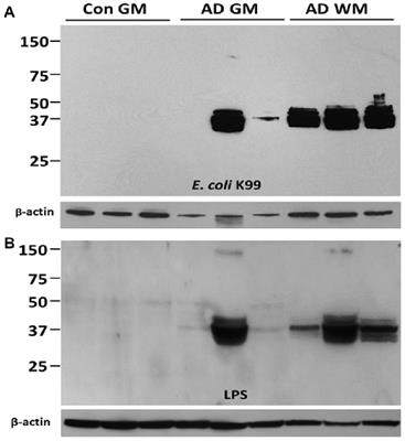 Lipopolysaccharide Associates with Amyloid Plaques, Neurons and Oligodendrocytes in Alzheimer’s Disease Brain: A Review